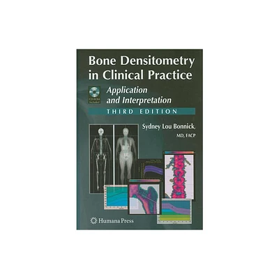 Bone Densitometry in Clinical Practice - (Current Clinical Practice (Humana)) 3rd Edition by Sydney Lou Bonnick (Mixed Media Product)