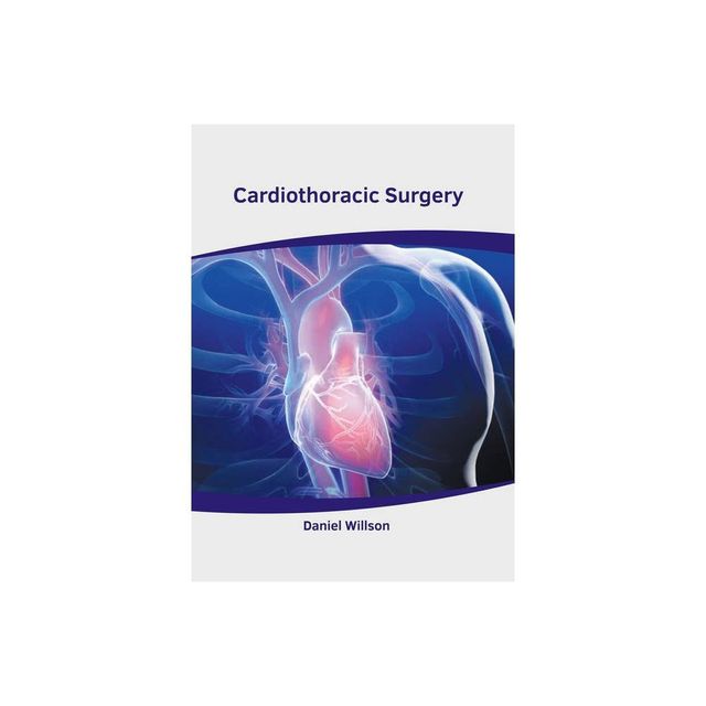 TARGET Cardiac Surgery Handbook - by Jessica Clan (Hardcover) | Connecticut  Post Mall