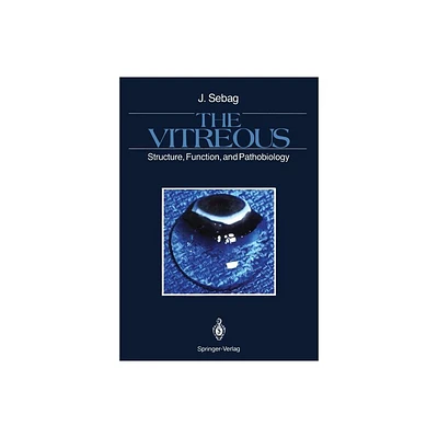 The Vitreous - by J Sebag (Paperback)