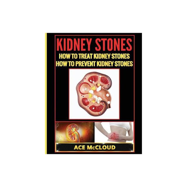 Kidney Stones - (Kidney Stone Treatment & Prevention Guide with All) by Ace McCloud (Paperback)