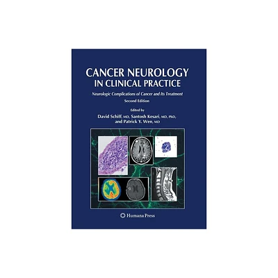 Cancer Neurology in Clinical Practice - 2nd Edition by David Schiff & Santosh Kesari & Patrick C y Wen (Paperback)