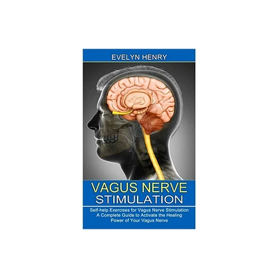 Vagus Nerve Stimulation - by Evelyn Henry (Paperback)