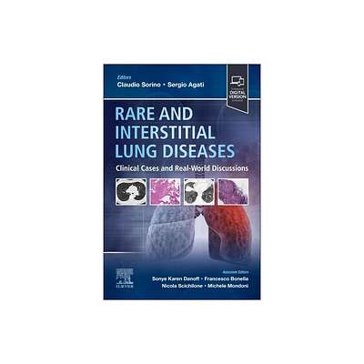 Rare and Interstitial Lung Diseases - by Claudio Sorino & Sergio Agati (Paperback)