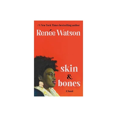 Skin & Bones - by Rene Watson (Hardcover)