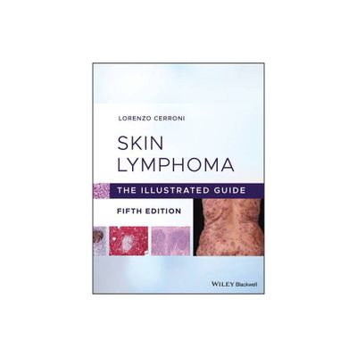 Skin Lymphoma - 5th Edition by Lorenzo Cerroni (Hardcover)