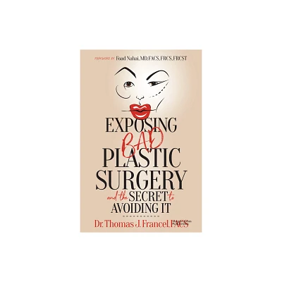 Exposing Bad Plastic Surgery - by Thomas J Francel (Paperback)