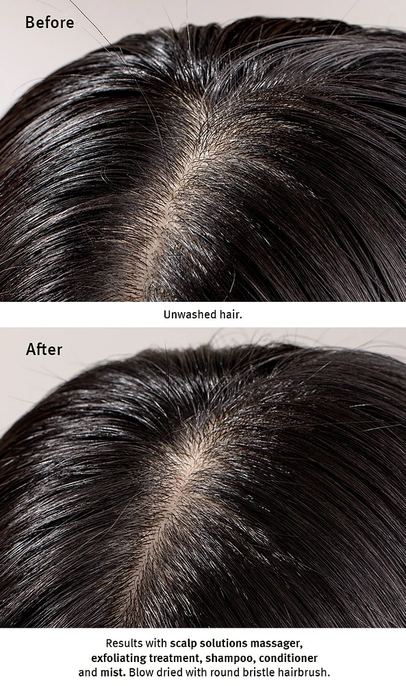 scalp solutions balancing shampoo