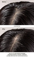 scalp solutions balancing shampoo