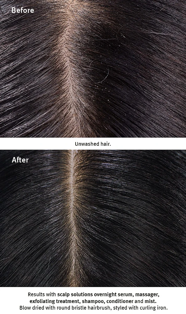scalp solutions overnight scalp renewal serum