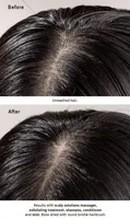 scalp solutions exfoliating treatment