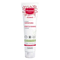 Stretch Marks Prevention Cream 150ml