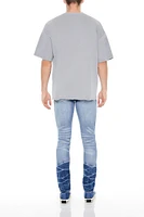 Distressed Acid Wash Skinny Jeans