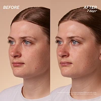 Immortelle Overnight Reset Oil-in-Serum