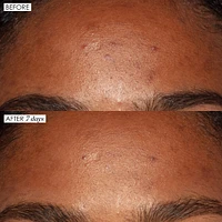 Good Genes All-In-One Lactic Acid Serum For Dark Spots And Uneven Texture