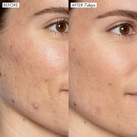 Good Genes All-In-One Lactic Acid Serum For Dark Spots And Uneven Texture