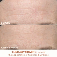Alpha Beta® Ultra Gentle Daily Peel Pads for Sensitive Skin
