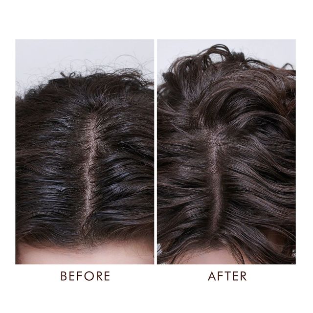 Oily Scalp Treatment