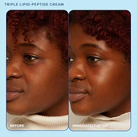 barrier+ Strengthening and Moisturizing Triple Lipid-Peptide Refillable Cream with B-L3