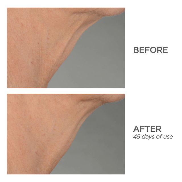 R45 The Lift 3-Phase Advanced Neck Contouring Treatment