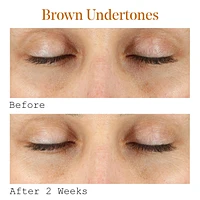 Vitamin C Dark Circle Correcting Eye Serum