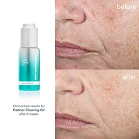 Retinol Acne Clearing Oil