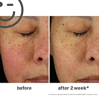 KateCeuticals® Total Repair Cream						