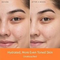 First Care Activating Serum for Anti-Aging