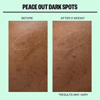 Microneedling Dark Spot Brightening Dots