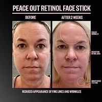 Retinol Face Stick