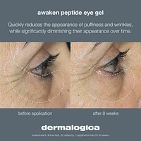 Awaken Peptide Depuffing Eye Gel
