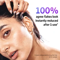 Salicylic Acid Oily Scalp Treatment