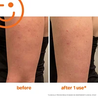 ExfoliKate™ Resurfacing Body Scrub with AHA, BHA & Caffeine