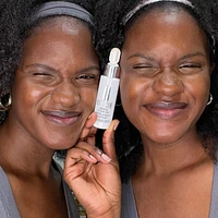 Clarifying Do-Over Peel
