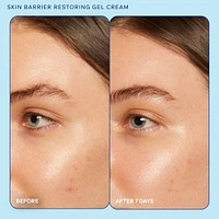 Skin Barrier Restoring + Pore Refining Gel Cream with Niacinamide