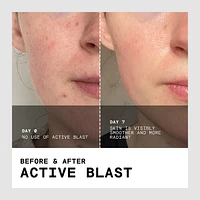 Active Blast Concentrated Collagen Daily Treatment