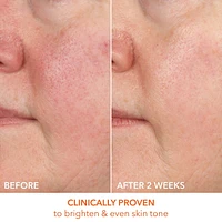 Vitamin C Lactic 15% Firm & Bright Serum