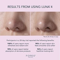 LUNA™ 4 Facial Cleansing & Firming Massage for Sensitive Skin