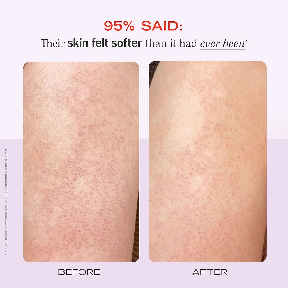 KP Bump Eraser Body Scrub with 10% AHA –  Fresh Strawberry