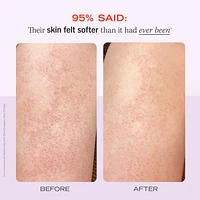 KP Bump Eraser Body Scrub with 10% AHA –  Fresh Strawberry