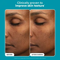 Mini Skin Perfecting 6% Mandelic Acid + 2% Lactic Acid Liquid Exfoliant