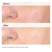 Alpha Arbutin 2% + HA Hyperpigmentation Serum
