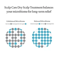 Scalp Care Dry Scalp Treatment