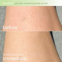 Resurface+ Glycolic and Lactic Acid Renewing Body Scrub