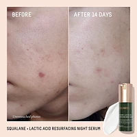 Squalane + 10% Lactic Acid Resurfacing Serum
