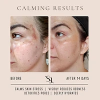 Luxury Beauty Serum Calming Treatment