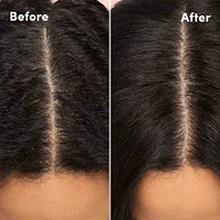 Scalp Care Soothing Scalp Lotion