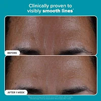 Skin Perfecting 2% BHA Exfoliating Toner for Clear