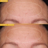 Filling Good Hyaluronic Acid Plumping Serum