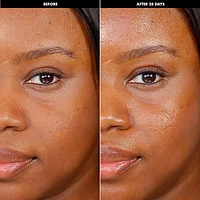 All Day Hydrator Hyaluronic Acid Moisturizer 
