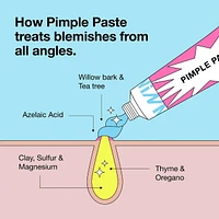Pimple Paste Overnight Blemish Spot Treatment